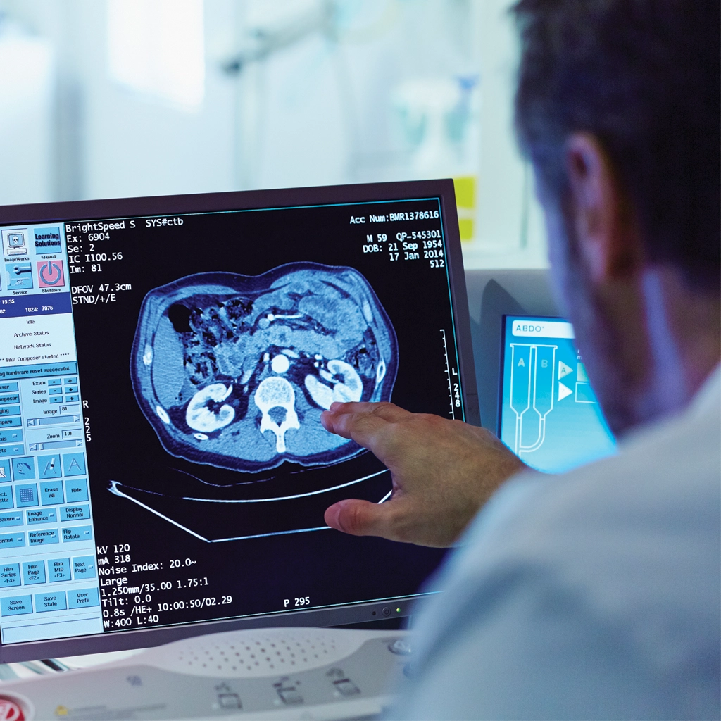 Computed Tomography (CT)