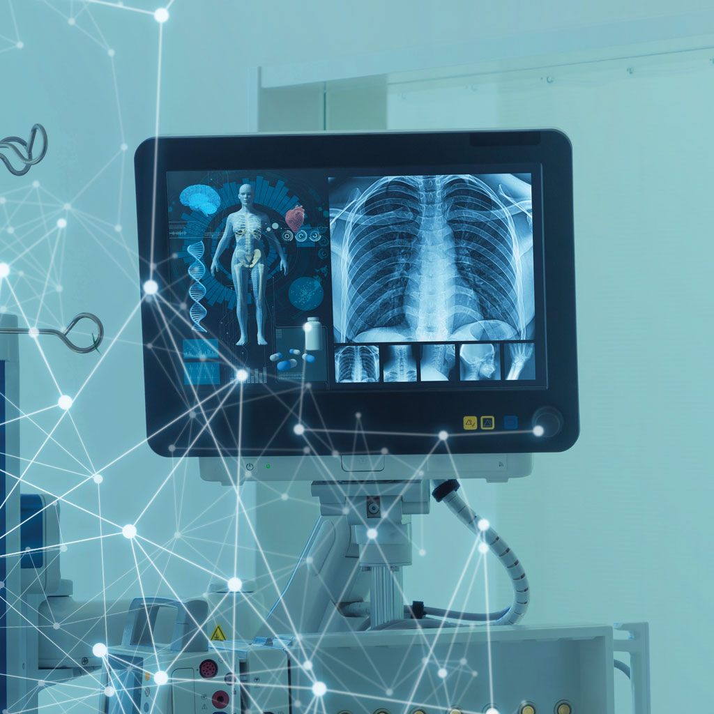 Various Types of Medical Imaging Screen